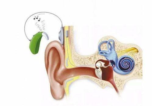 装国产耳蜗宝宝视频,温馨视频展现成长奇迹